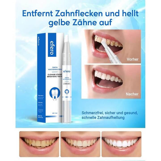 MaxBright™ - Zahnaufhellungsstift (1+1 GRATIS)