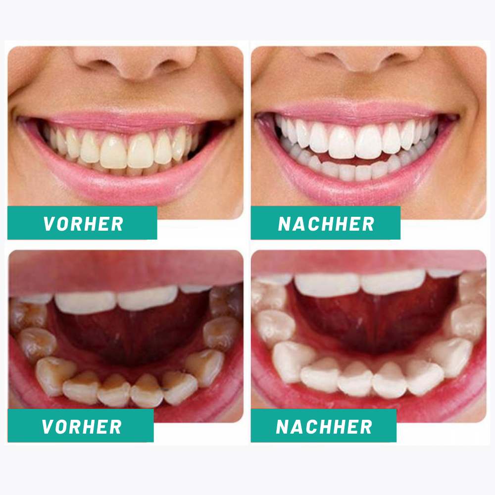 Aliver® I Zahnpasta Whitening-Schaum (1+1 GRATIS)