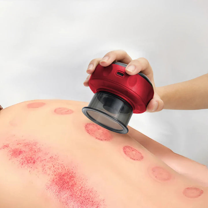 PainAway™ - Elektrisches Schröpfmassagegerät