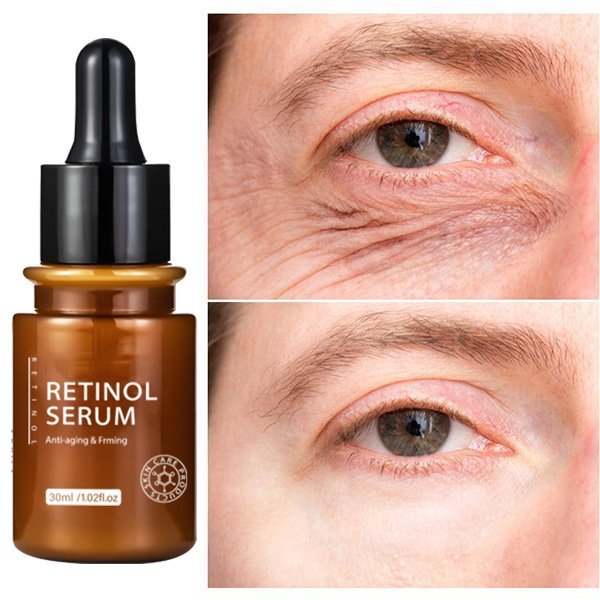 Neue Retinol-Gesichtsessenz | 1+2 GRATIS