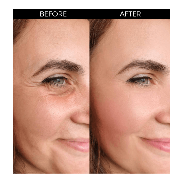 Neue Retinol-Gesichtsessenz | 1+2 GRATIS