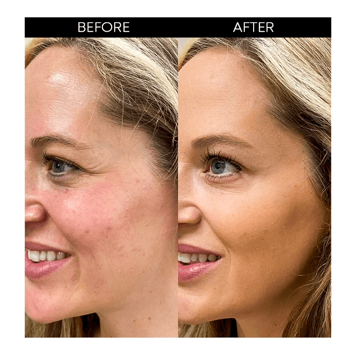 Neue Retinol-Gesichtsessenz | 1+2 GRATIS