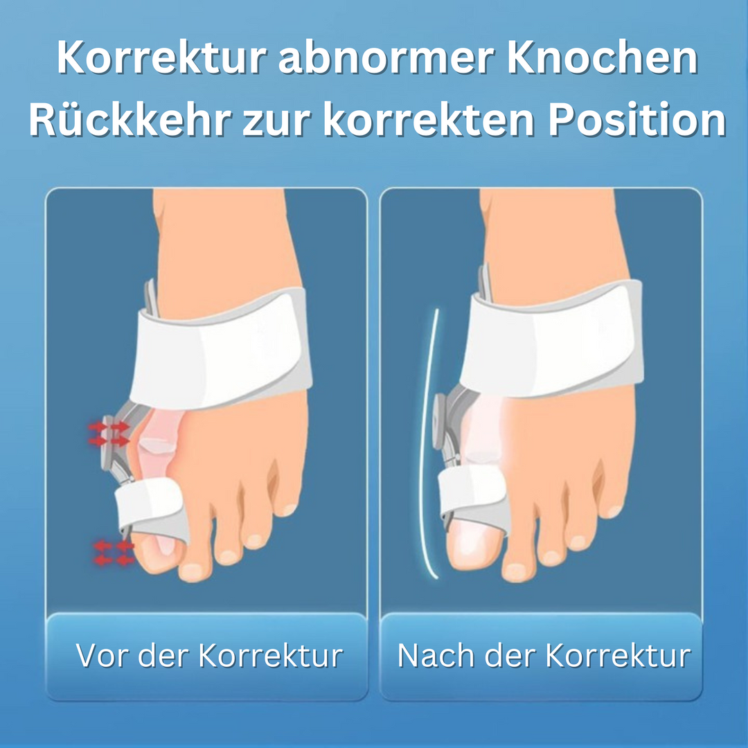 Orthocure™️ I Verstellbarer Ballenzeh-Korrektor