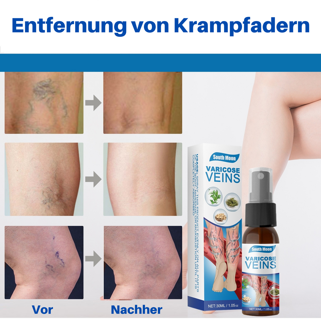 VeinHealer™ - Venenbehandlungsspray (1+1 GRATIS)